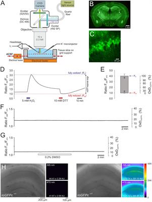 Quantitative, real-time imaging of spreading depolarization-associated neuronal ROS production